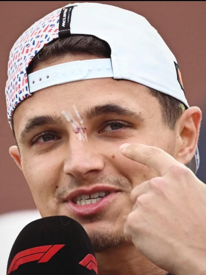 Imagen Así quedó el rostro de Lando Norris tras el accidente con un fotógrafo.