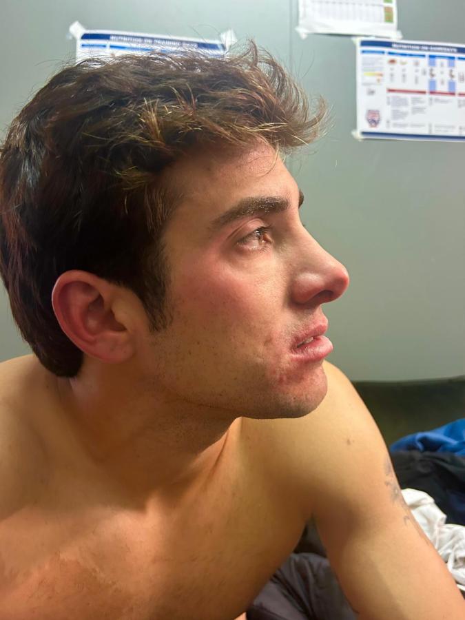 Imagen Así le quedó el ojo a Cristian Garín. Foto: Séptimo Game
