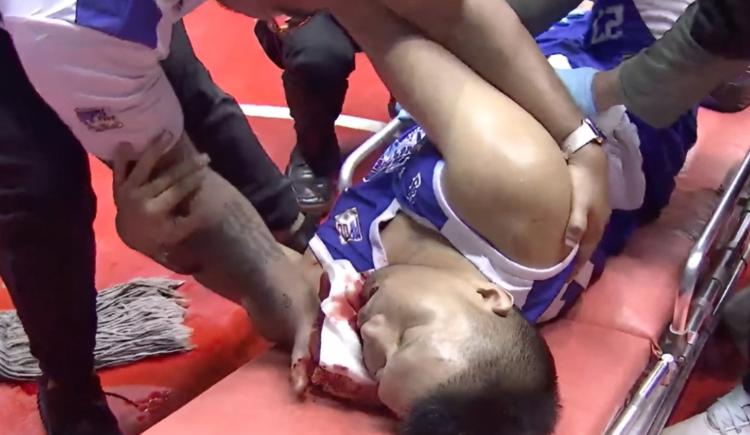 Imagen de Golpeó a traición a un rival en un partido de básquet y lo mandó al hospital: fue suspendido de por vida